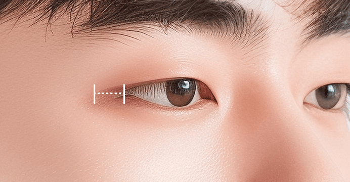 눈 길이 연장
