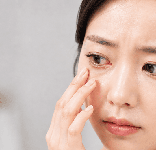 결막염 vs 안구건조증