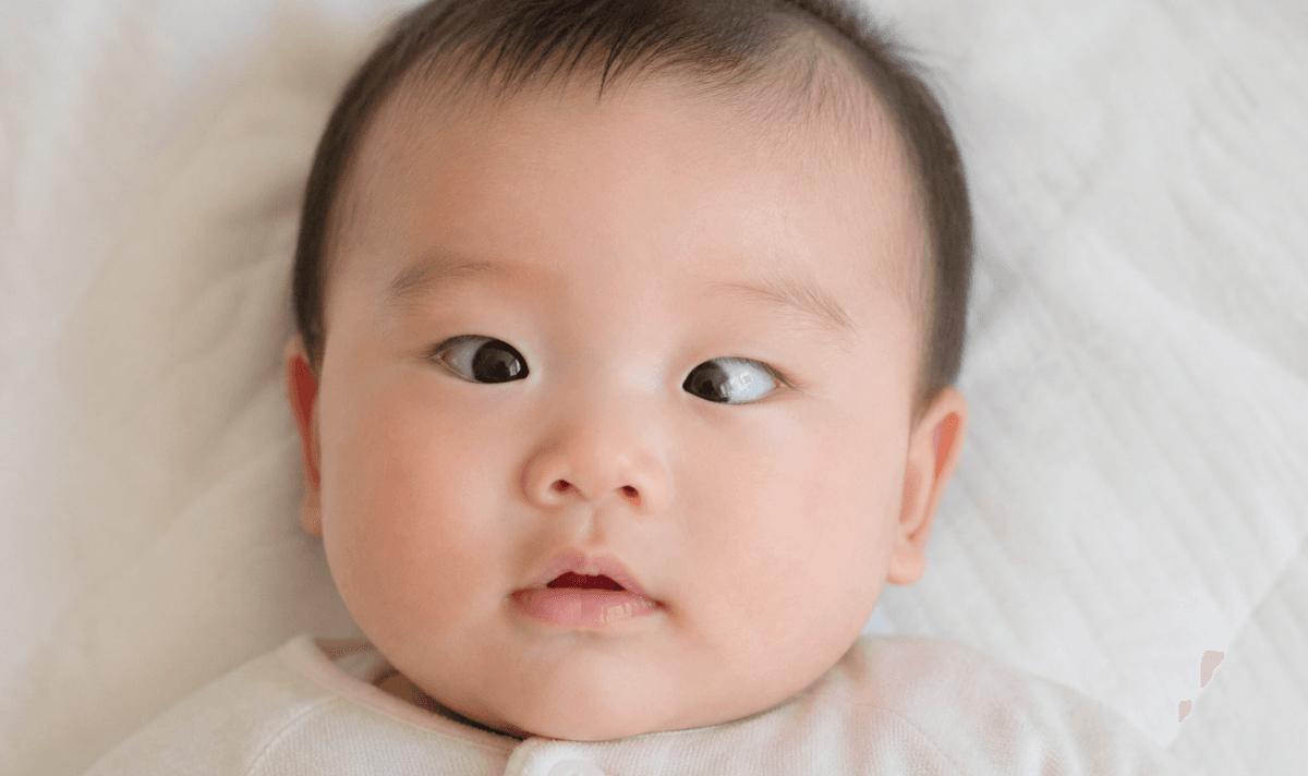 사시성 약시