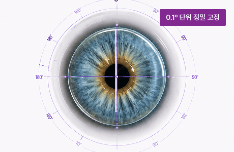 난시 축 정밀 고정